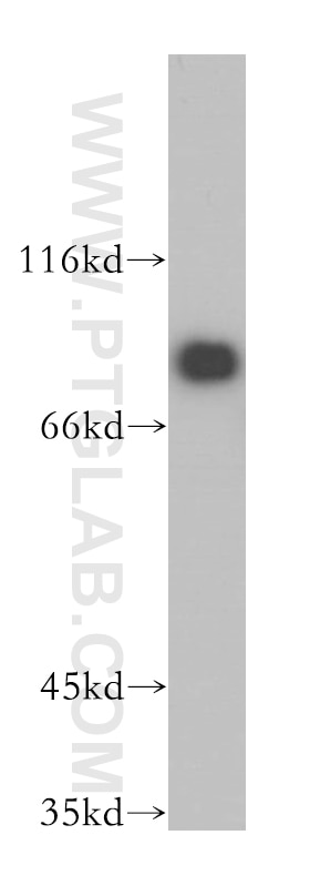 Western Blot (WB) analysis of HeLa cells using EIF4B Polyclonal antibody (17917-1-AP)