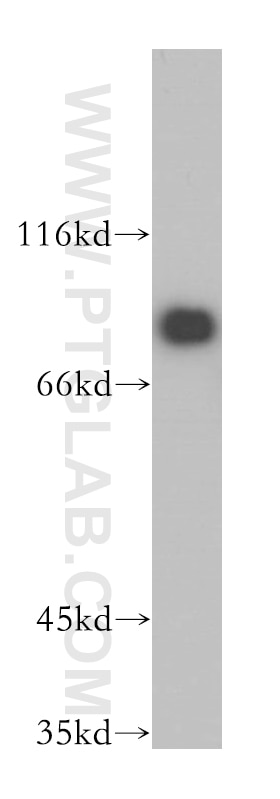 WB analysis of HeLa using 17917-1-AP