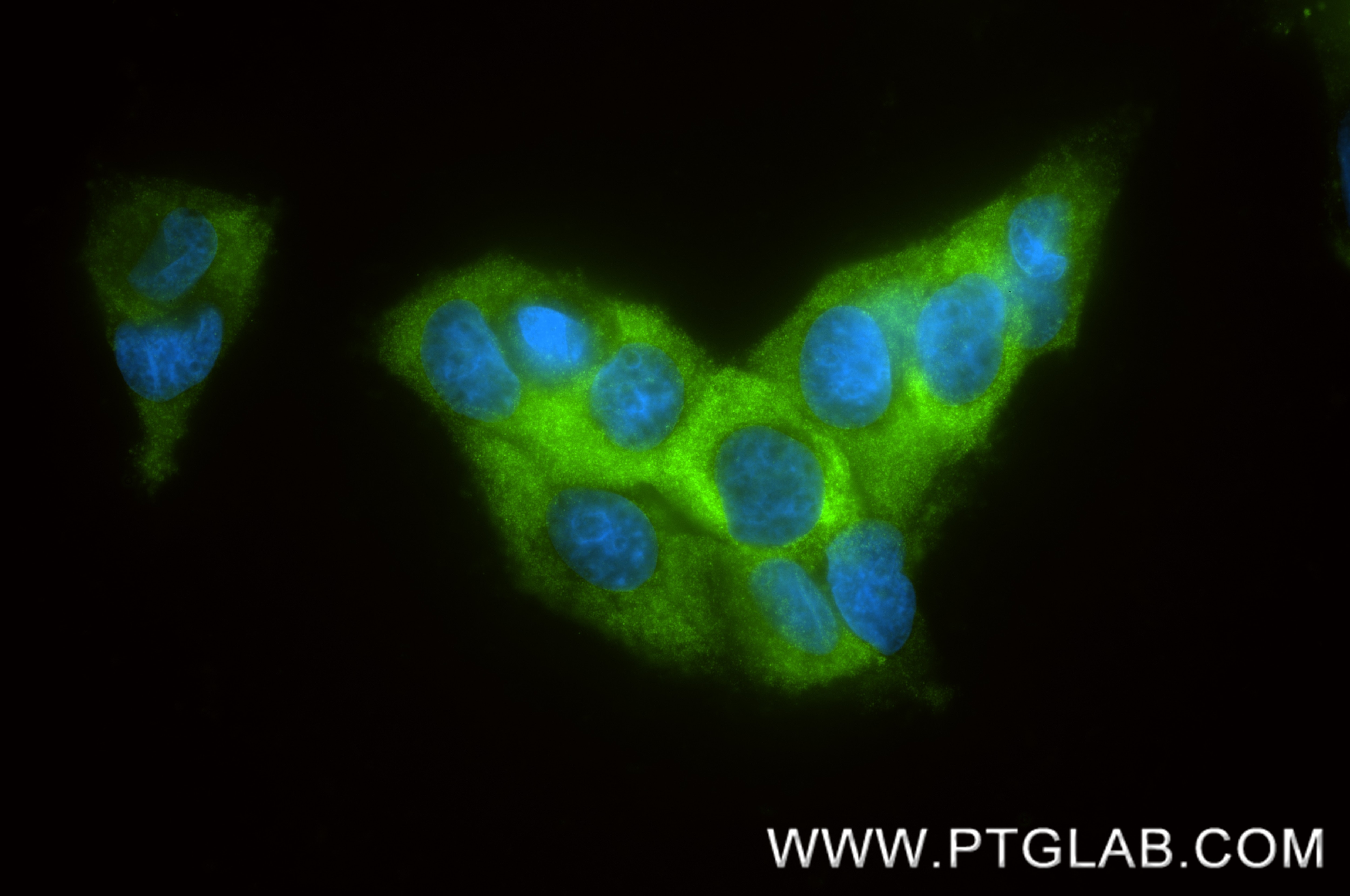 IF Staining of MCF-7 using 88367-1-RR (same clone as 88367-1-PBS) Immunofluorescence (IF) / fluorescent staining of MCF-7 cells using EIF4B Recombinant monoclonal antibody (88367-1-RR)