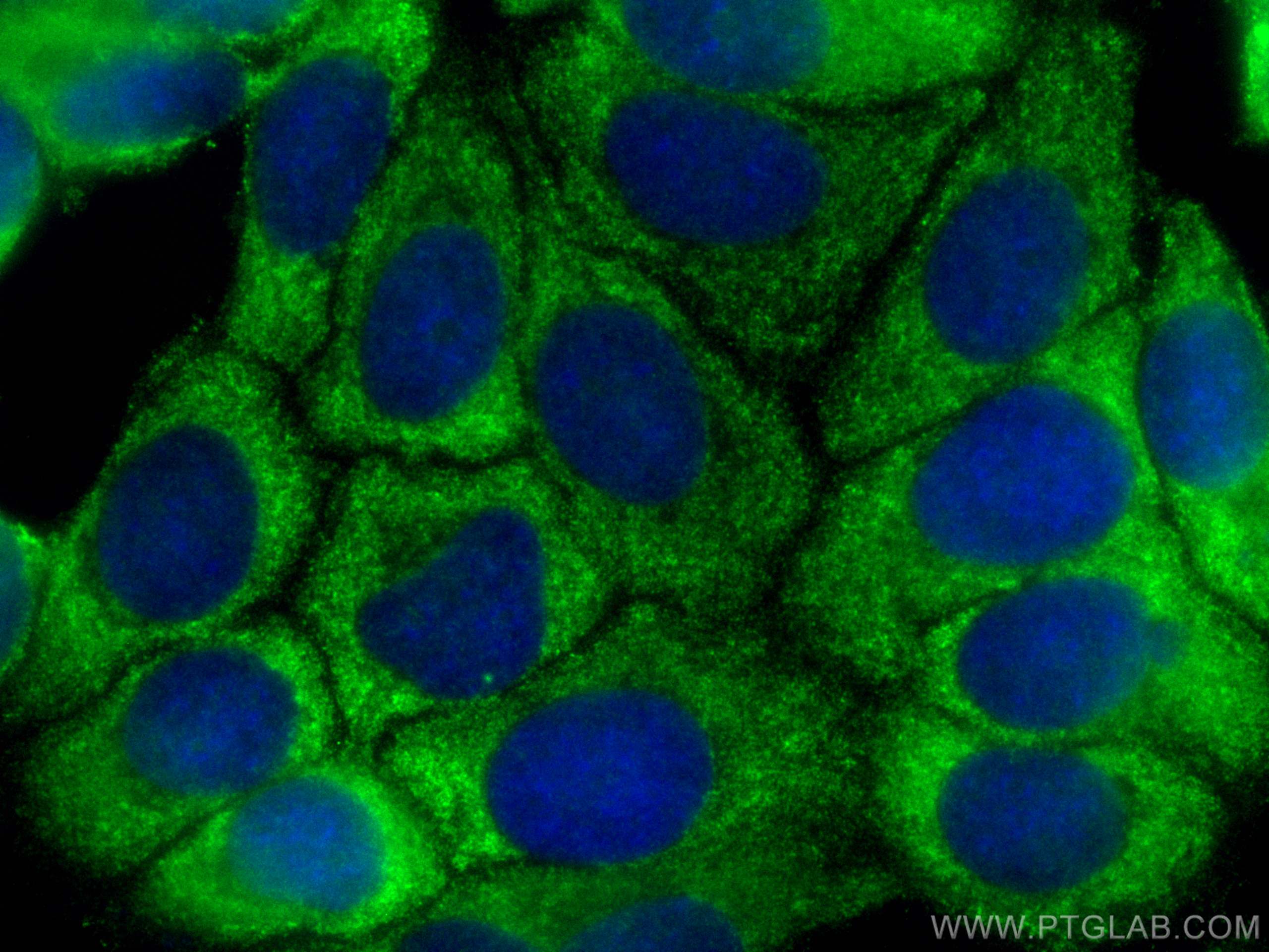 Immunofluorescence (IF) / fluorescent staining of MCF-7 cells using CoraLite® Plus 488-conjugated EIF4B Polyclonal ant (CL488-17917)