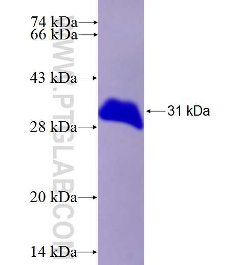 EIF4E fusion protein Ag27191 SDS-PAGE