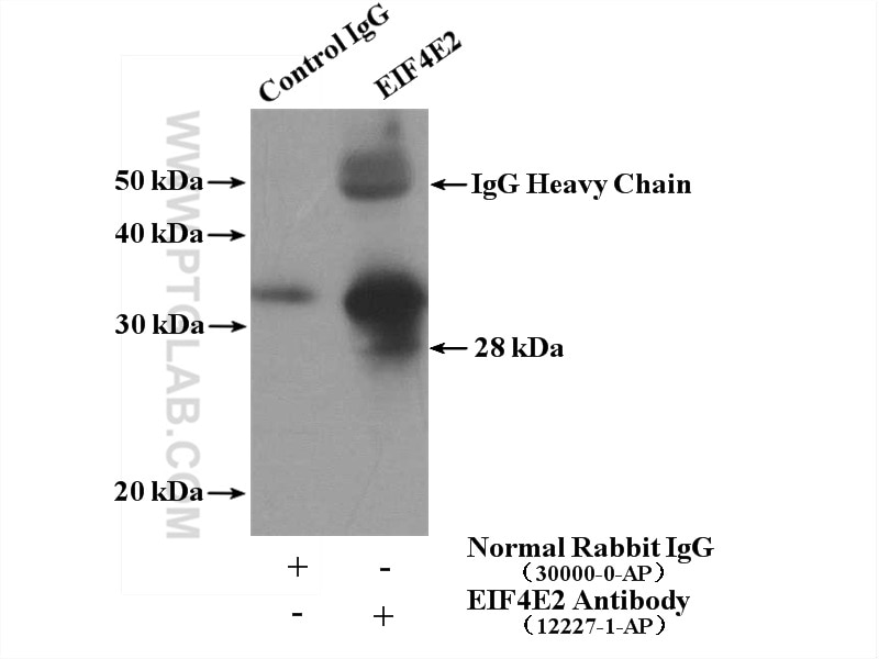 Immunoprecipitation (IP) experiment of MCF-7 cells using EIF4E2 Polyclonal antibody (12227-1-AP)