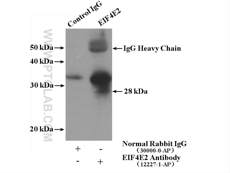 IP experiment of MCF-7 using 12227-1-AP