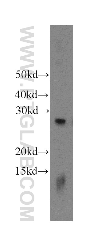 Western Blot (WB) analysis of HeLa cells using EIF4E2 Polyclonal antibody (12227-1-AP)