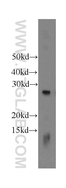 WB analysis of HeLa using 12227-1-AP