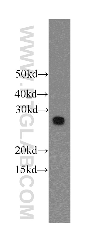 EIF4E2 Polyclonal antibody