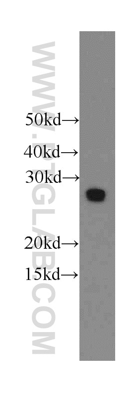 Western Blot (WB) analysis of HeLa cells using EIF4E2 Polyclonal antibody (12227-1-AP)