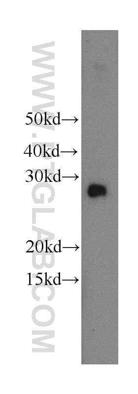 Western Blot (WB) analysis of MCF-7 cells using EIF4E2 Polyclonal antibody (12227-1-AP)