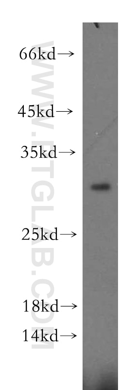 Western Blot (WB) analysis of mouse kidney tissue using EIF4E2 Polyclonal antibody (12227-1-AP)