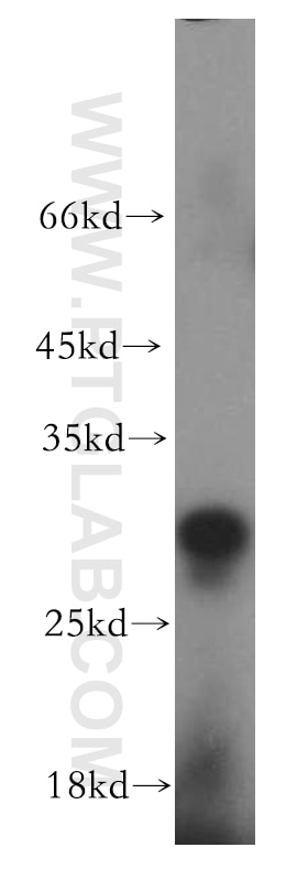 Western Blot (WB) analysis of MCF-7 cells using EIF4E2 Polyclonal antibody (12227-1-AP)