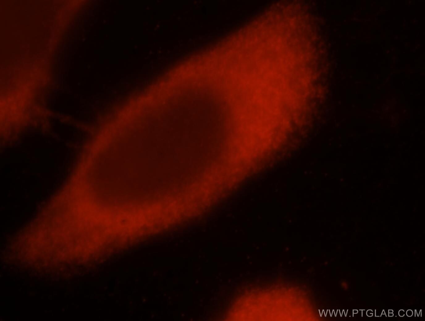 Immunofluorescence (IF) / fluorescent staining of HeLa cells using EIF4E3 Polyclonal antibody (17282-1-AP)