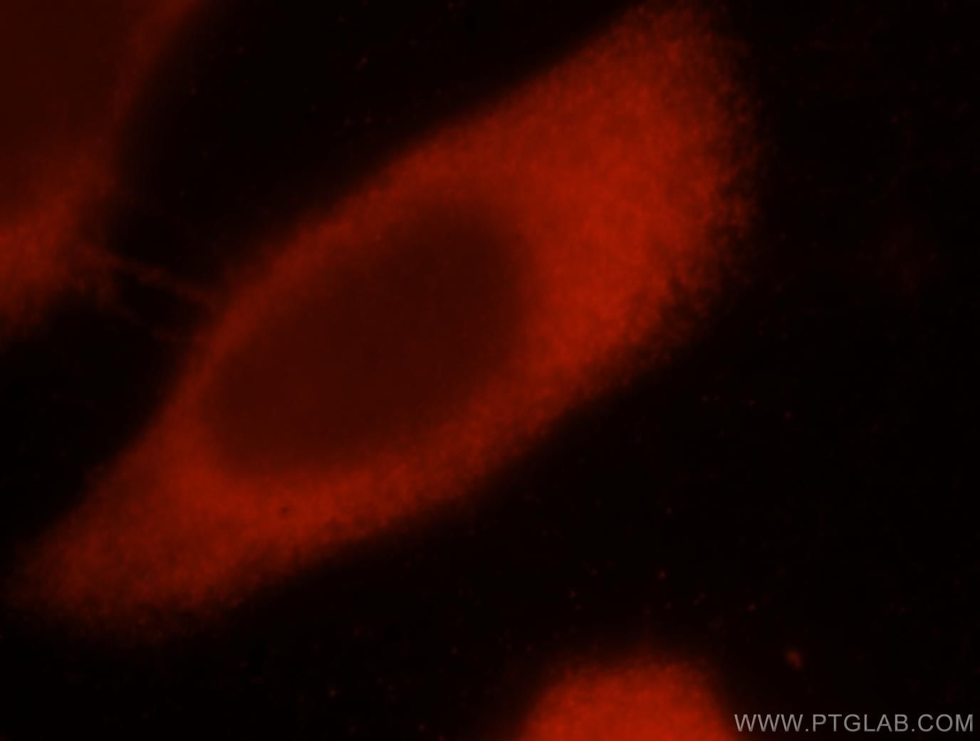 Immunofluorescence (IF) / fluorescent staining of HeLa cells using EIF4E3 Polyclonal antibody (17282-1-AP)