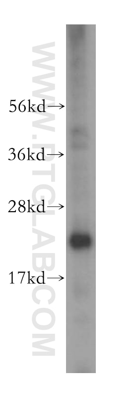 Western Blot (WB) analysis of HeLa cells using EIF4E3 Polyclonal antibody (17282-1-AP)