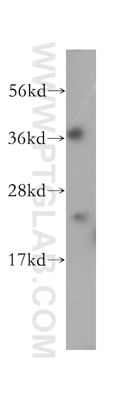 Western Blot (WB) analysis of mouse heart tissue using EIF4E3 Polyclonal antibody (17282-1-AP)