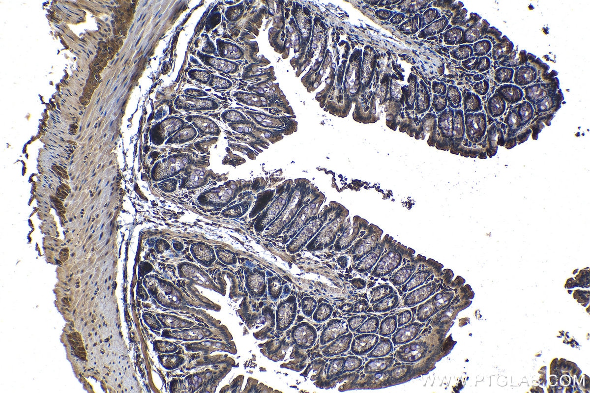 Immunohistochemistry (IHC) staining of mouse colon tissue using EIF4E3 Monoclonal antibody (68171-1-Ig)