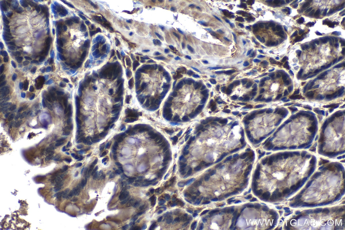 Immunohistochemistry (IHC) staining of mouse colon tissue using EIF4E3 Monoclonal antibody (68171-1-Ig)