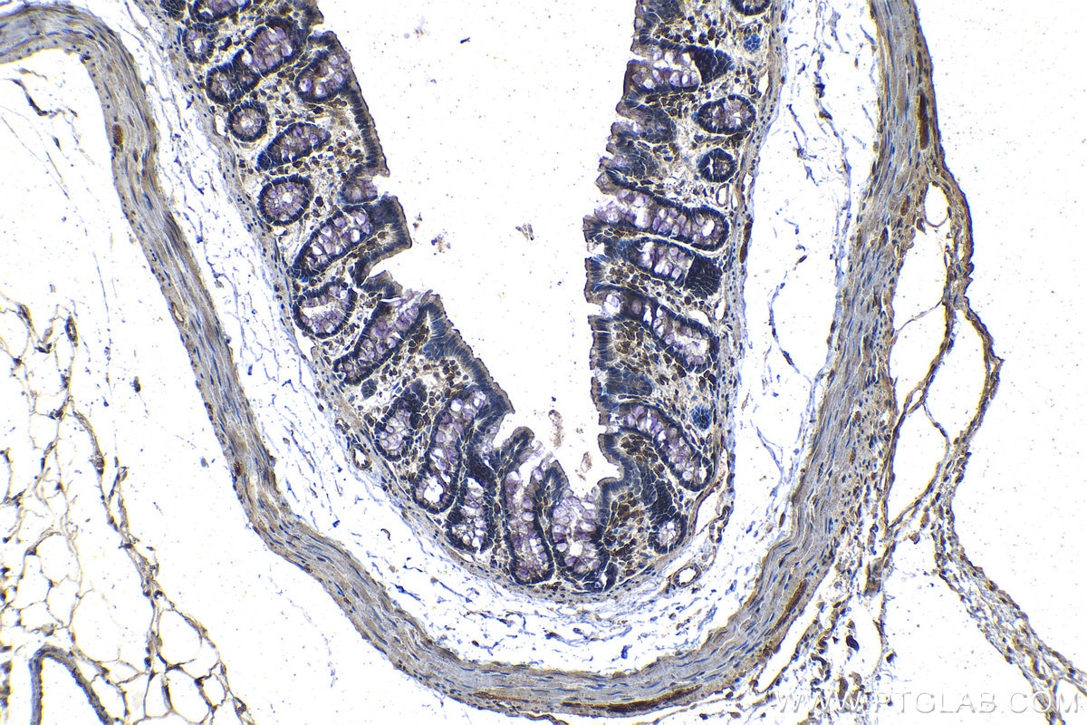 Immunohistochemistry (IHC) staining of rat colon tissue using EIF4E3 Monoclonal antibody (68171-1-Ig)