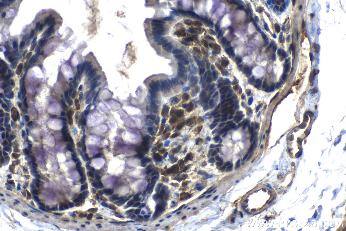 Immunohistochemistry (IHC) staining of rat colon tissue using EIF4E3 Monoclonal antibody (68171-1-Ig)
