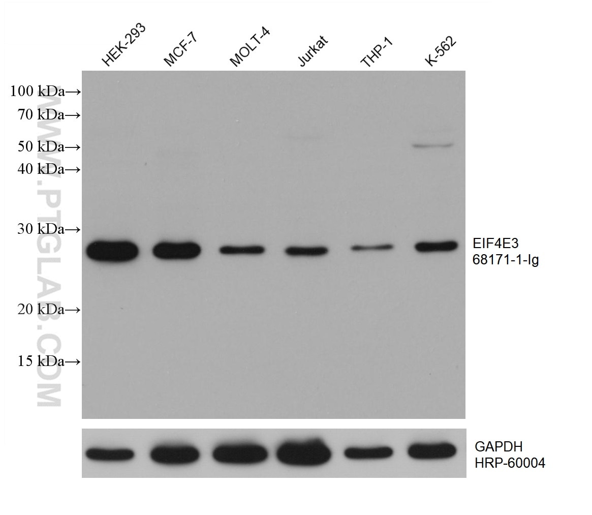 WB analysis using 68171-1-Ig