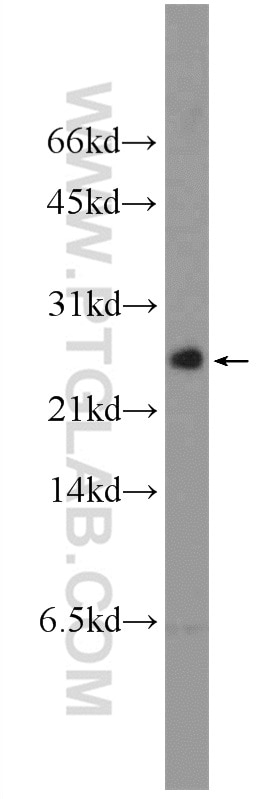 Western Blot (WB) analysis of mouse testis tissue using EIF4EBP2 Polyclonal antibody (11182-1-AP)