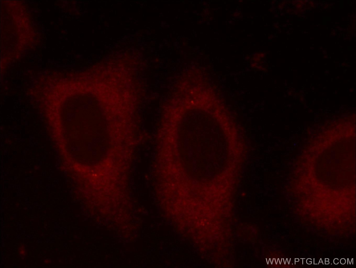 Immunofluorescence (IF) / fluorescent staining of HepG2 cells using EIF4G1 Polyclonal antibody (15704-1-AP)