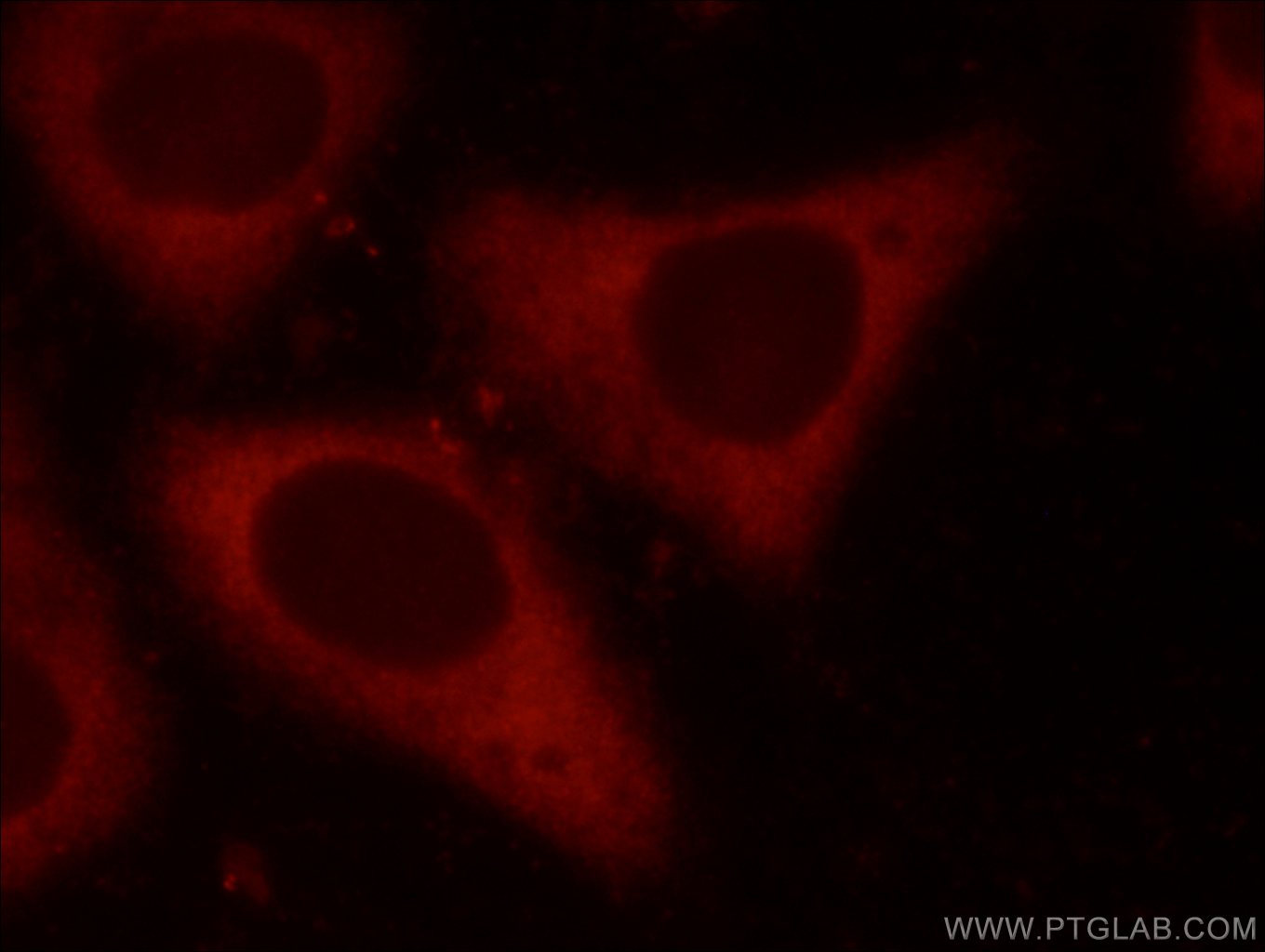 Immunofluorescence (IF) / fluorescent staining of HepG2 cells using EIF4G1 Polyclonal antibody (15704-1-AP)