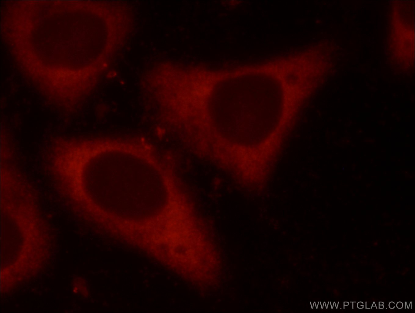 IF Staining of HepG2 using 15704-1-AP