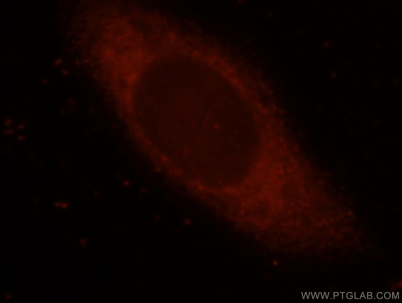 Immunofluorescence (IF) / fluorescent staining of HeLa cells using EIF4G1 Polyclonal antibody (15704-1-AP)