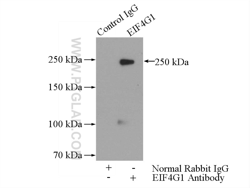 Immunoprecipitation (IP) experiment of HeLa cells using EIF4G1 Polyclonal antibody (15704-1-AP)