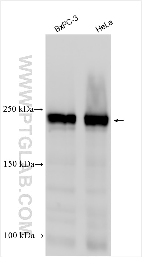 Western Blot (WB) analysis of various lysates using EIF4G1 Polyclonal antibody (15704-1-AP)