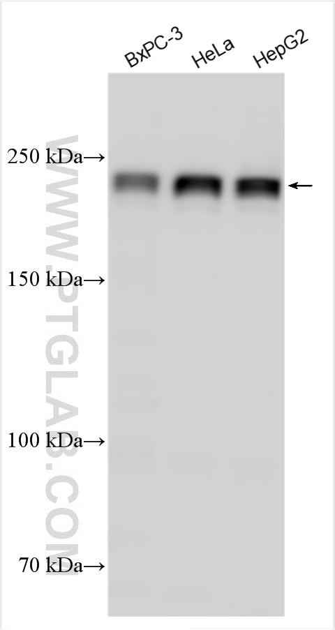 Western Blot (WB) analysis of various lysates using EIF4G1 Polyclonal antibody (15704-1-AP)