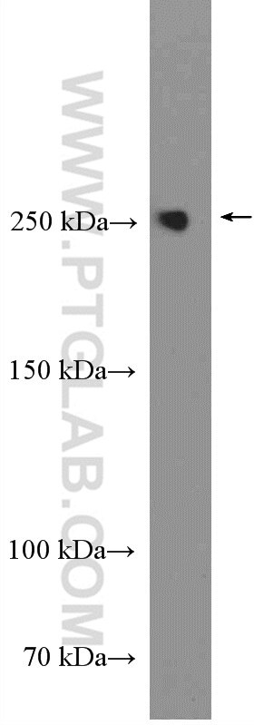 Western Blot (WB) analysis of BxPC-3 cells using EIF4G1 Polyclonal antibody (15704-1-AP)