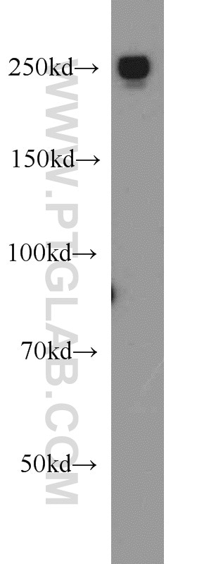 Western Blot (WB) analysis of HeLa cells using EIF4G1 Polyclonal antibody (15704-1-AP)