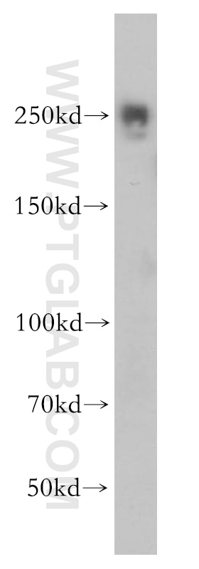 Western Blot (WB) analysis of HeLa cells using EIF4G1 Polyclonal antibody (15704-1-AP)