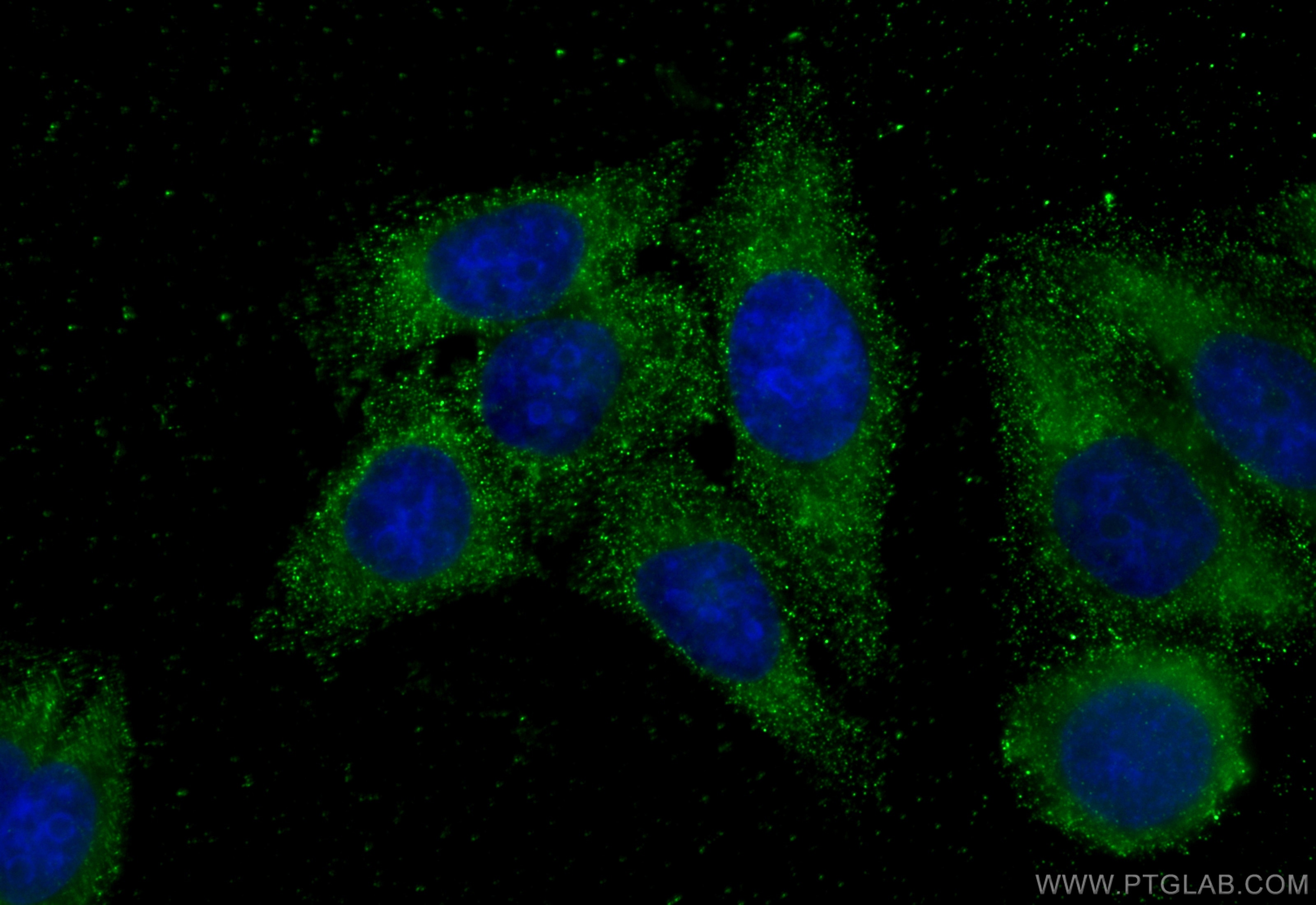 Immunofluorescence (IF) / fluorescent staining of HepG2 cells using EIF4G1 Monoclonal antibody (67199-1-Ig)