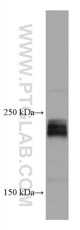 Western Blot (WB) analysis of 4T1 cells using EIF4G1 Monoclonal antibody (67199-1-Ig)