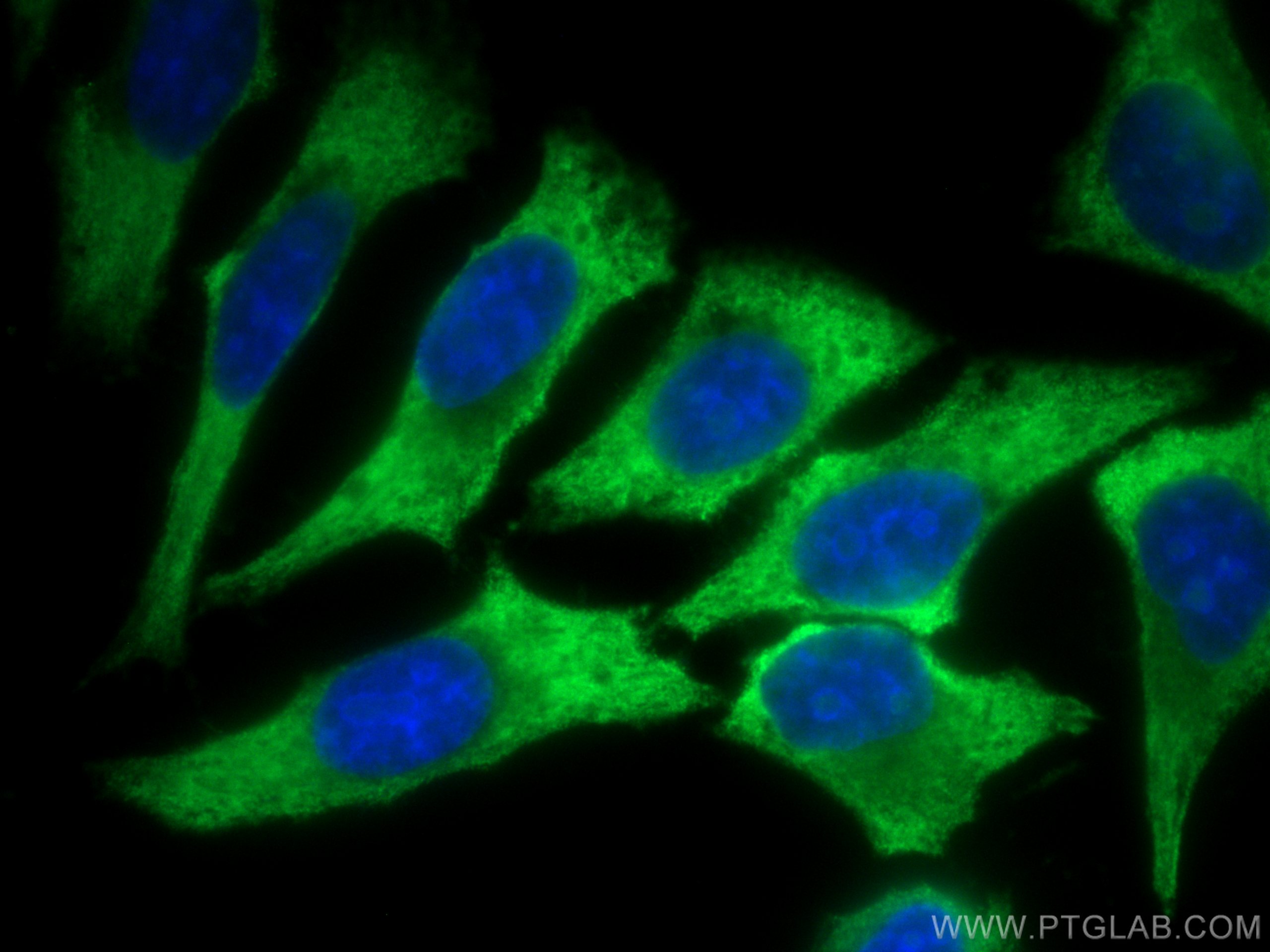 Immunofluorescence (IF) / fluorescent staining of HepG2 cells using CoraLite® Plus 488-conjugated EIF4G1 Monoclonal an (CL488-67199)