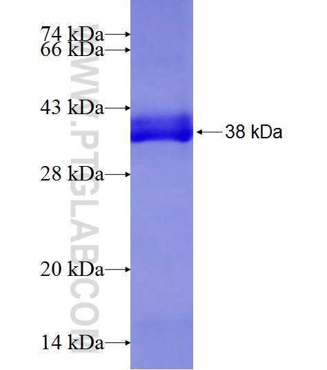 EIF4G1 fusion protein Ag8357 SDS-PAGE
