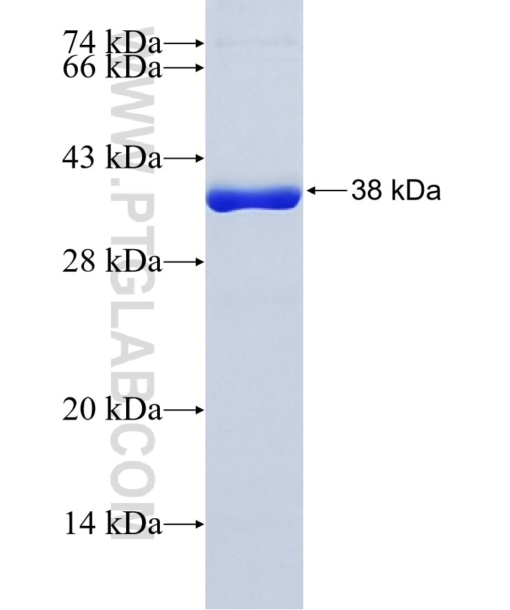 EIF4G1 fusion protein Ag8357 SDS-PAGE