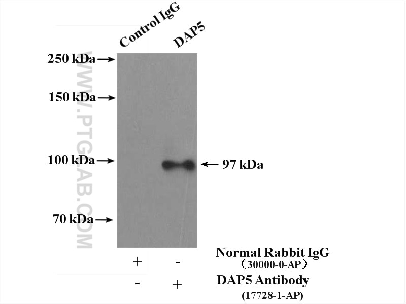 Immunoprecipitation (IP) experiment of MCF-7 cells using eIF4G2/DAP5 Polyclonal antibody (17728-1-AP)