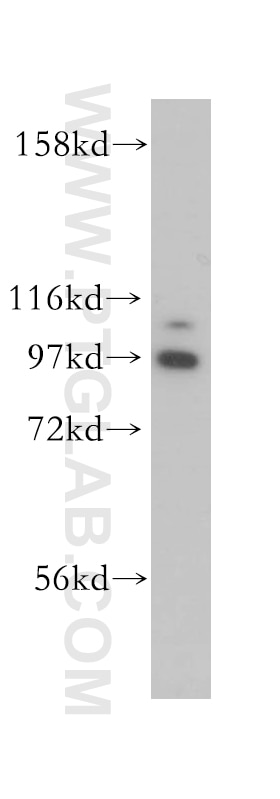Western Blot (WB) analysis of HeLa cells using eIF4G2/DAP5 Polyclonal antibody (17728-1-AP)