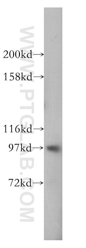 Western Blot (WB) analysis of MCF-7 cells using eIF4G2/DAP5 Polyclonal antibody (17728-1-AP)