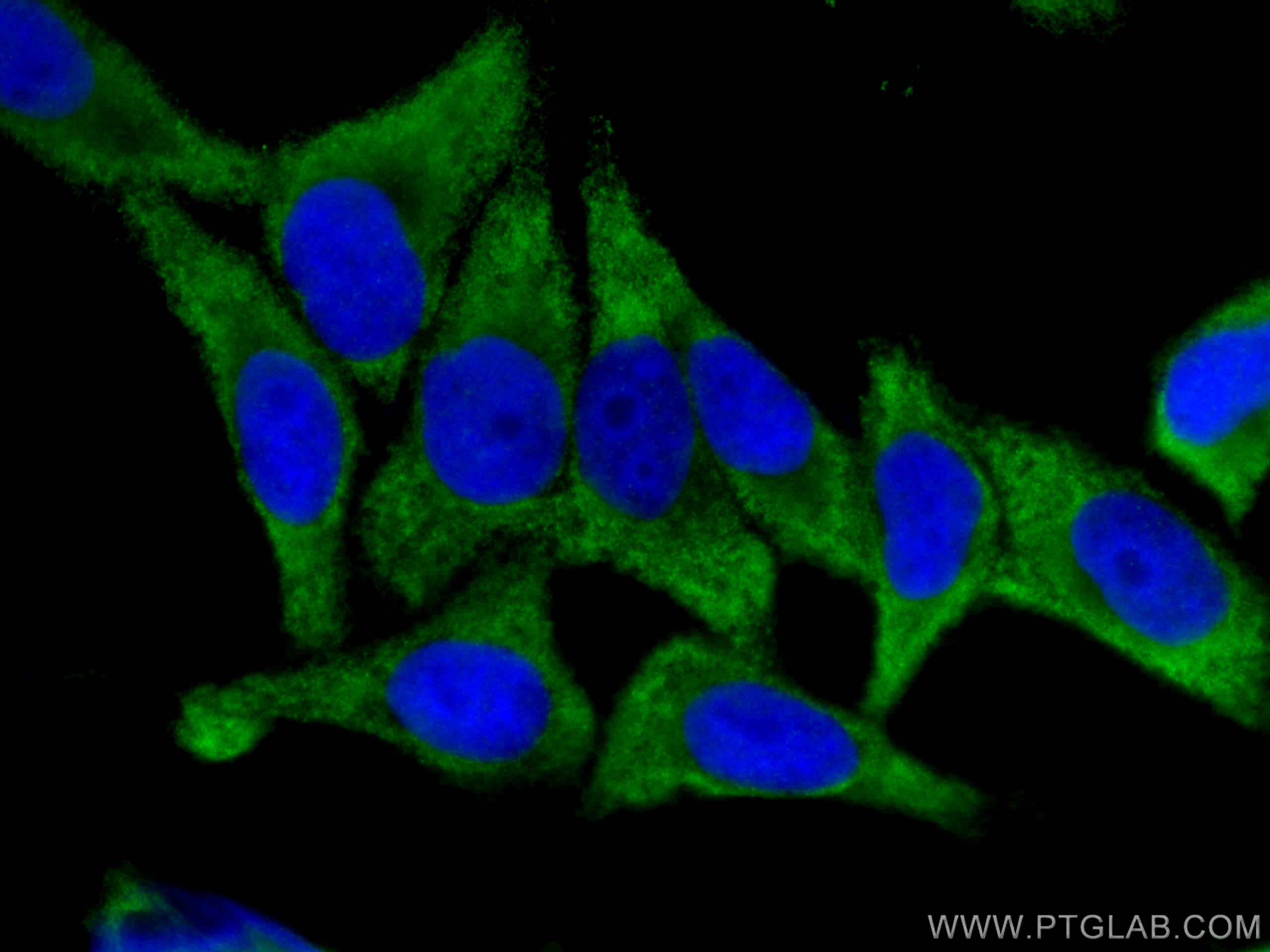 Immunofluorescence (IF) / fluorescent staining of HepG2 cells using eIF4G2/DAP5 Monoclonal antibody (67428-1-Ig)