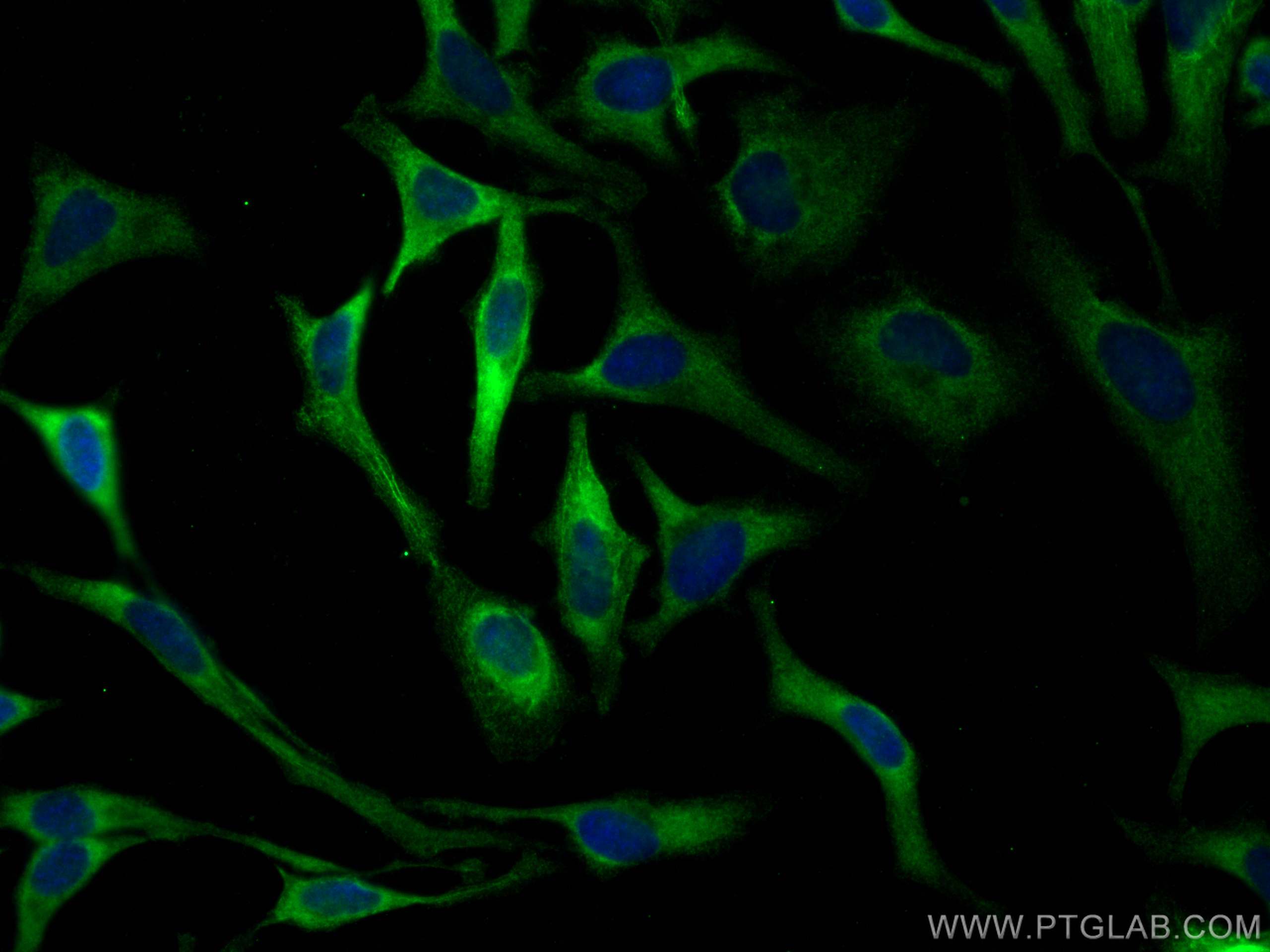 Immunofluorescence (IF) / fluorescent staining of HeLa cells using eIF4G2/DAP5 Monoclonal antibody (67428-1-Ig)