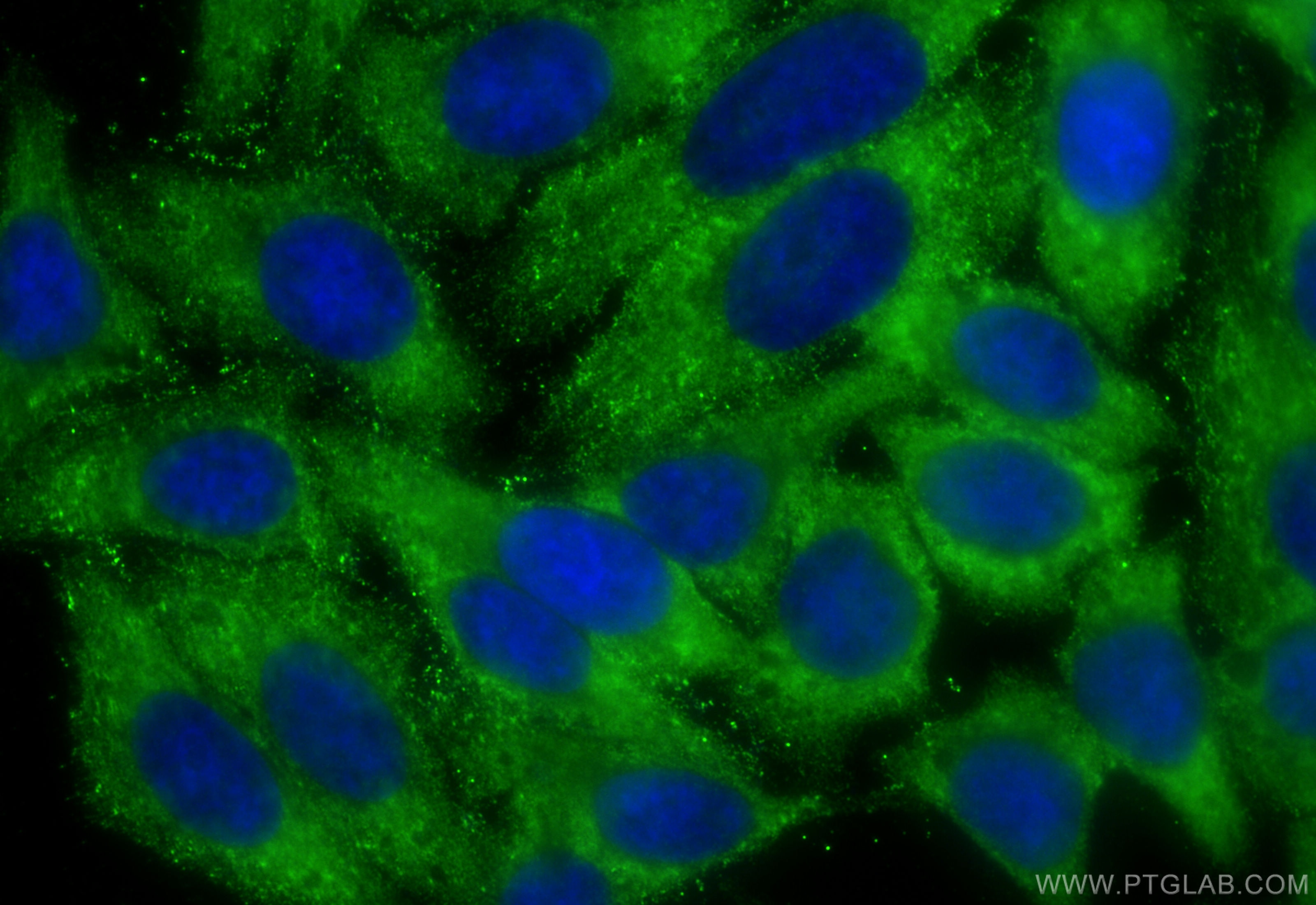 Immunofluorescence (IF) / fluorescent staining of HepG2 cells using eIF4G2/DAP5 Monoclonal antibody (67428-1-Ig)