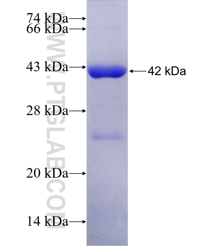 EIF4G2 fusion protein Ag12080 SDS-PAGE
