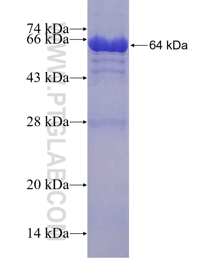 EIF4G2 fusion protein Ag12125 SDS-PAGE