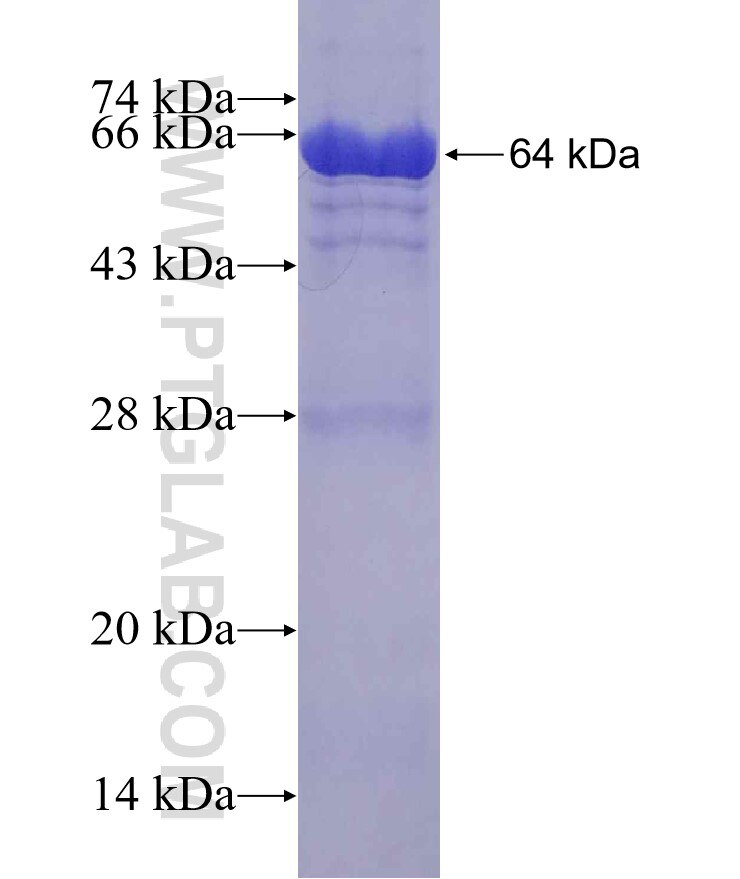 EIF4G2 fusion protein Ag12125 SDS-PAGE