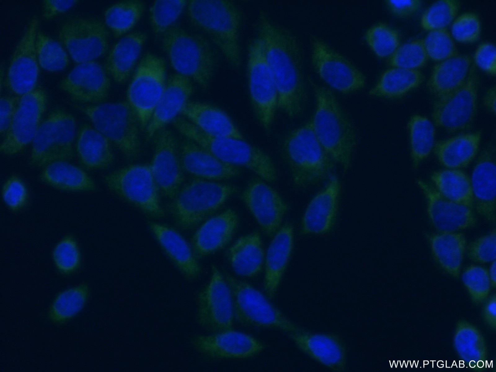 Immunofluorescence (IF) / fluorescent staining of HeLa cells using EIF4G3 Polyclonal antibody (11281-1-AP)