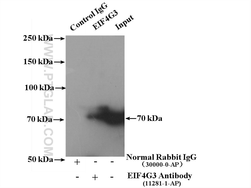 Immunoprecipitation (IP) experiment of HeLa cells using EIF4G3 Polyclonal antibody (11281-1-AP)